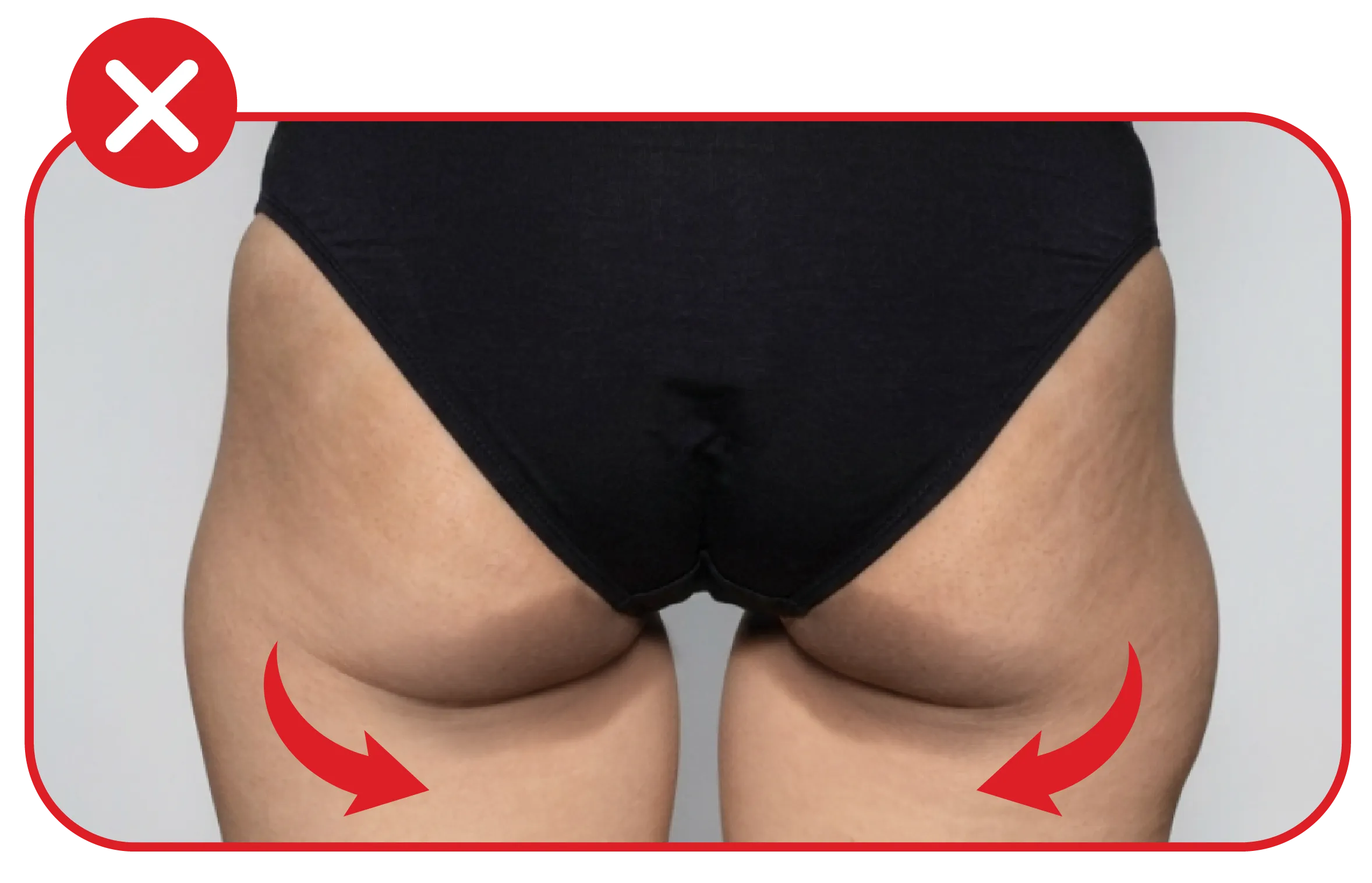 NoYa Swag Moon — hips before use, soft and sagging